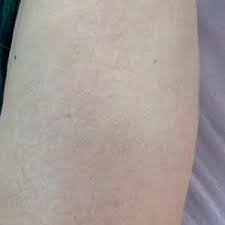 REGENSCAR STEM CELL REPAIR GEL – ВІДНОВЛЕННЯ ШКІРИ ТА ЗМЕНШЕННЯ СЛІДІВ НЕДОСКОНАЛОСТЕЙ