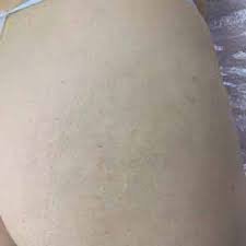 REGENSCAR STEM CELL REPAIR GEL – ВІДНОВЛЕННЯ ШКІРИ ТА ЗМЕНШЕННЯ СЛІДІВ НЕДОСКОНАЛОСТЕЙ