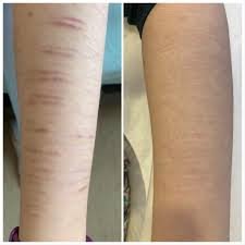 REGENSCAR STEM CELL REPAIR GEL – ВІДНОВЛЕННЯ ШКІРИ ТА ЗМЕНШЕННЯ СЛІДІВ НЕДОСКОНАЛОСТЕЙ